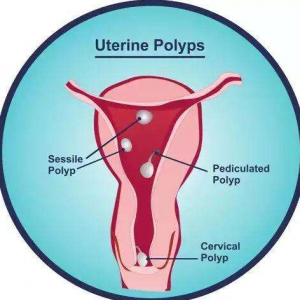 九江做试管婴儿需要多少钱？费用能省多少！